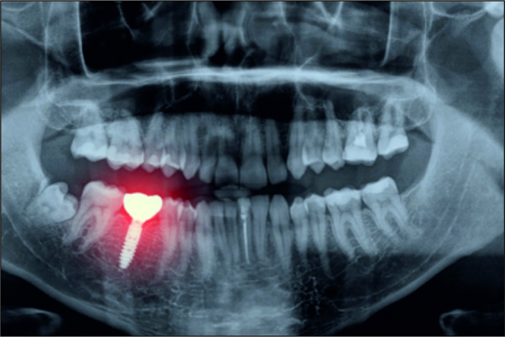 CBCT & OPG