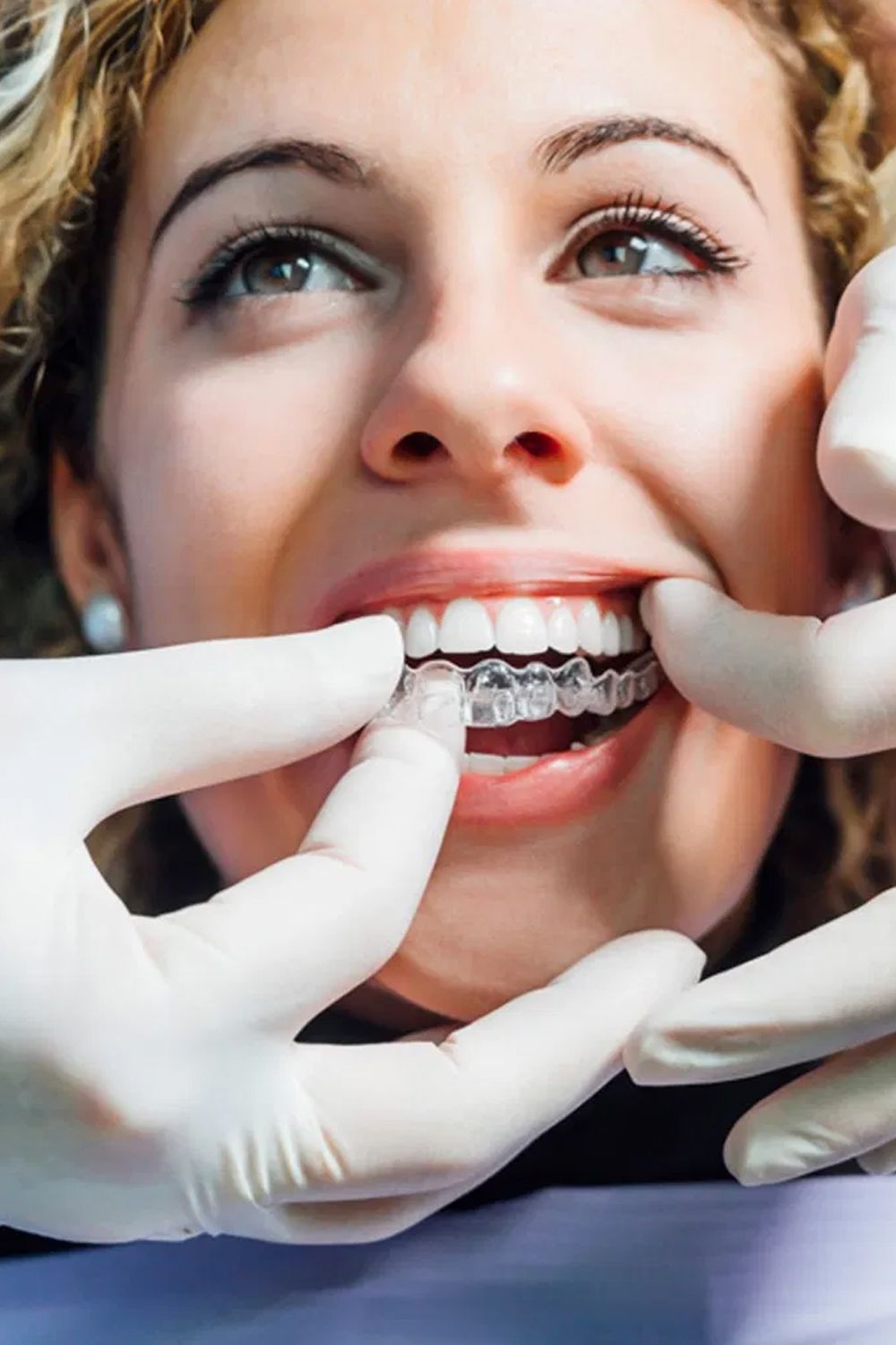 Invisaling Treatment In Chandigarh