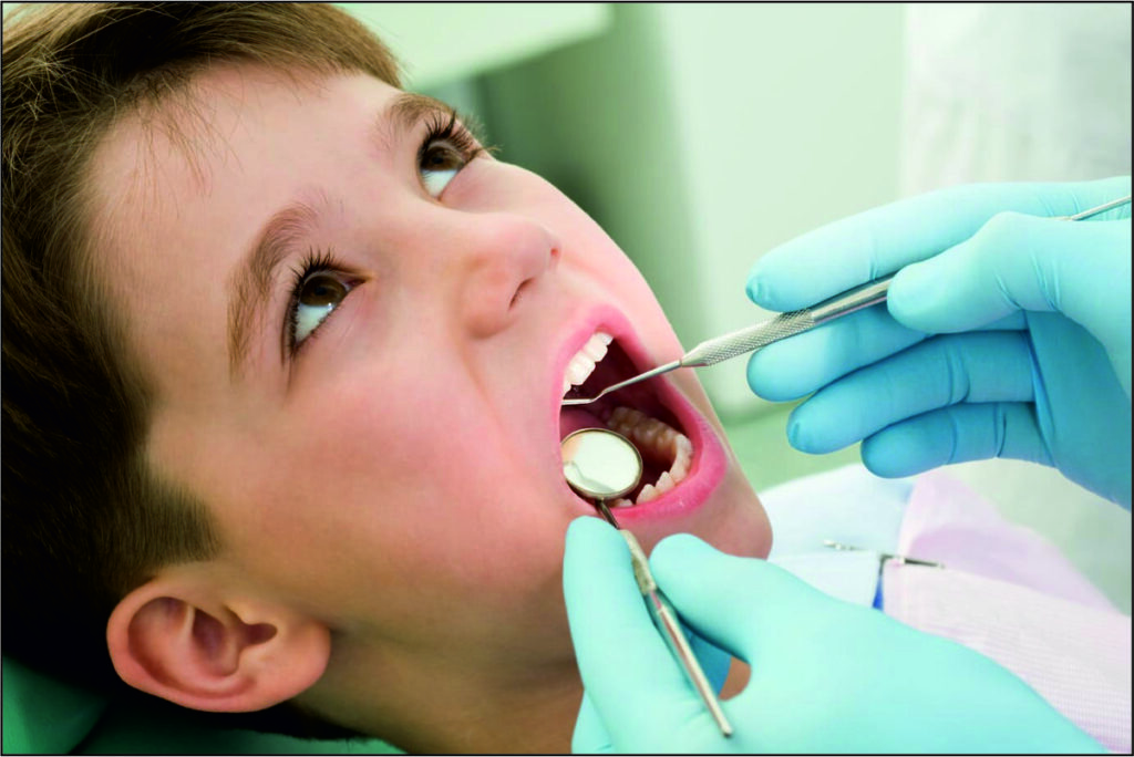 Tooth Cavity Treatment