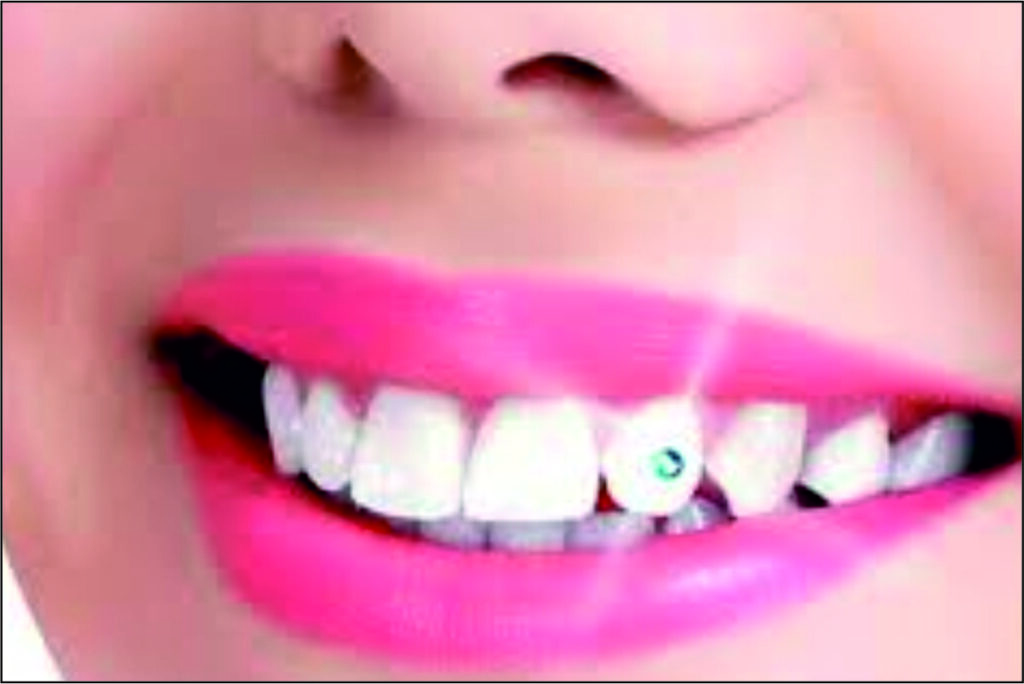 Tooth Jewellery