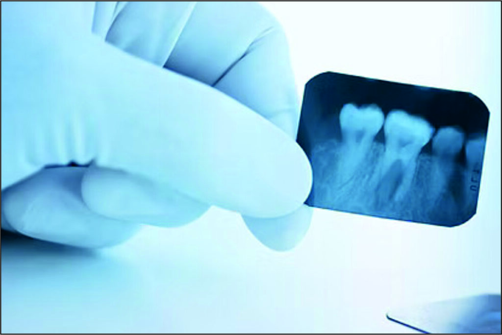 X-Ray