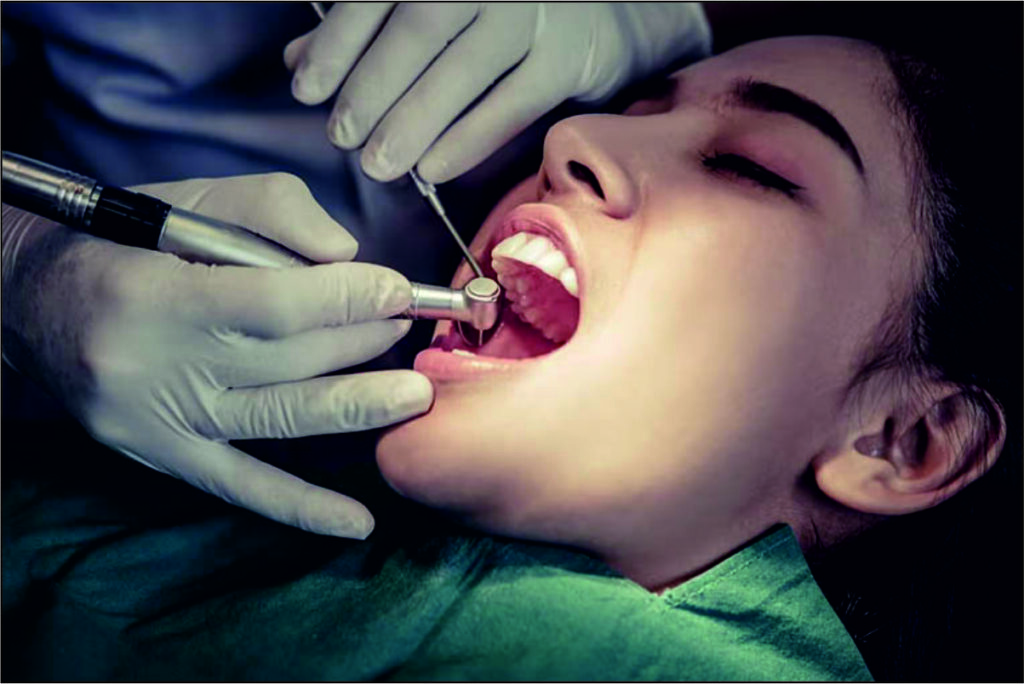 root canal treatment