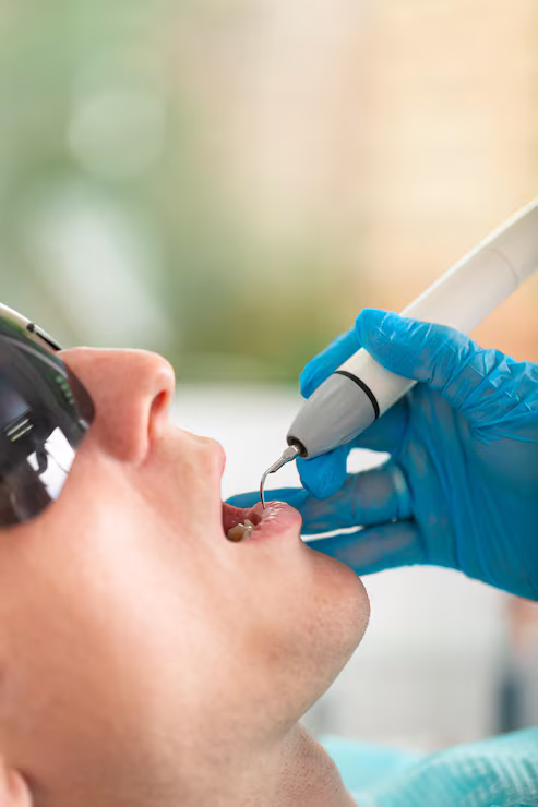 Our Dental Cleaning Procedure Dental Cleaning in Chandigarh