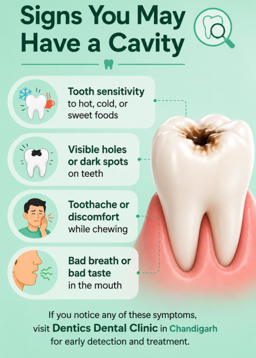 Cavities Treatment in Chandigarh Cavities Treatment in Chandigarh