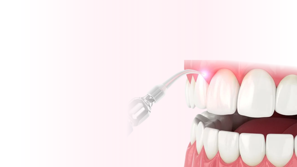 Surgical Dental Procedures in Chandigarh