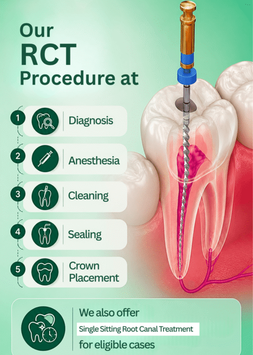 Root Canal Treatment