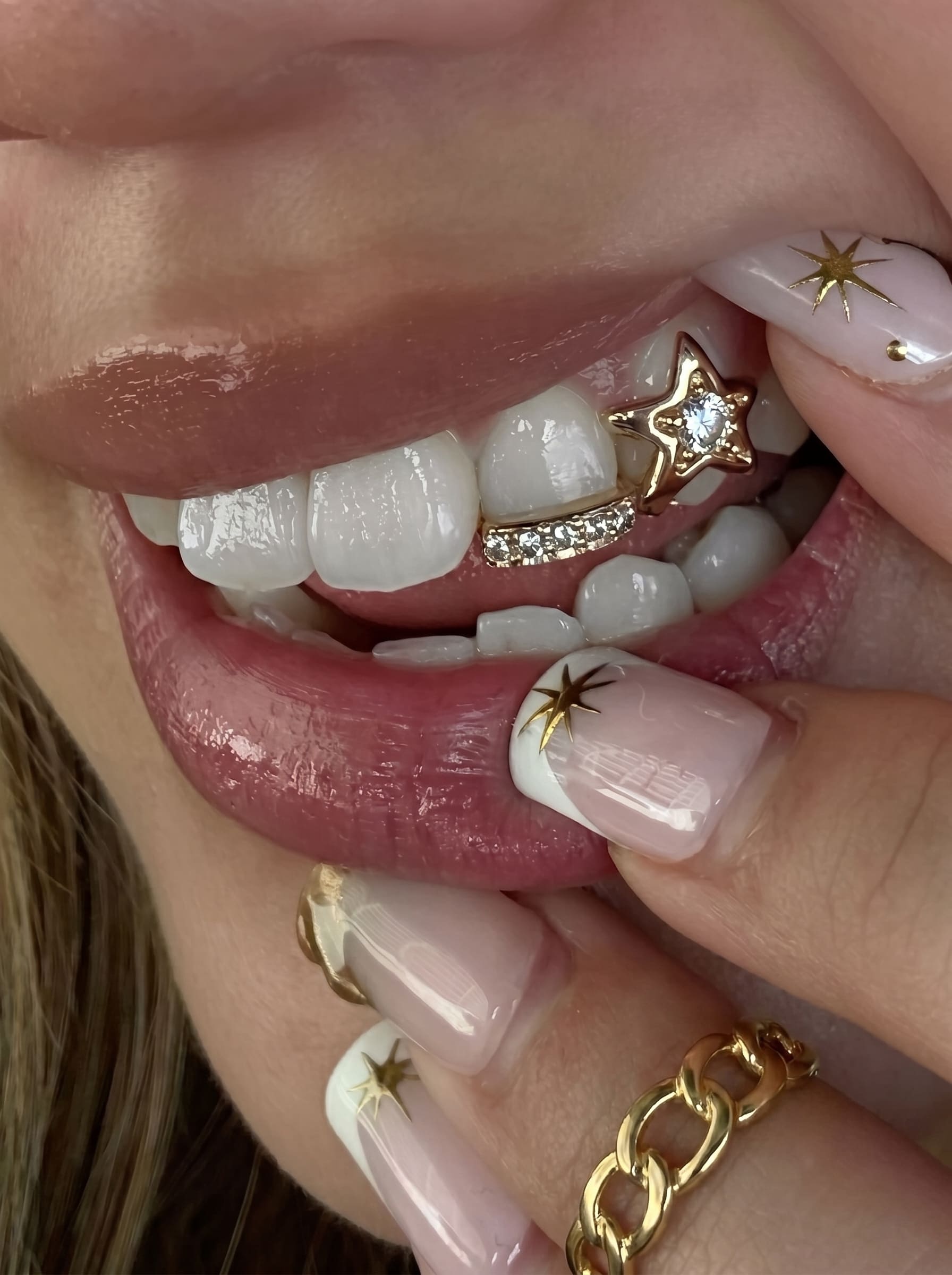 Tooth Jewellery in Chandigarh Tooth Jewellery in Chandigarh