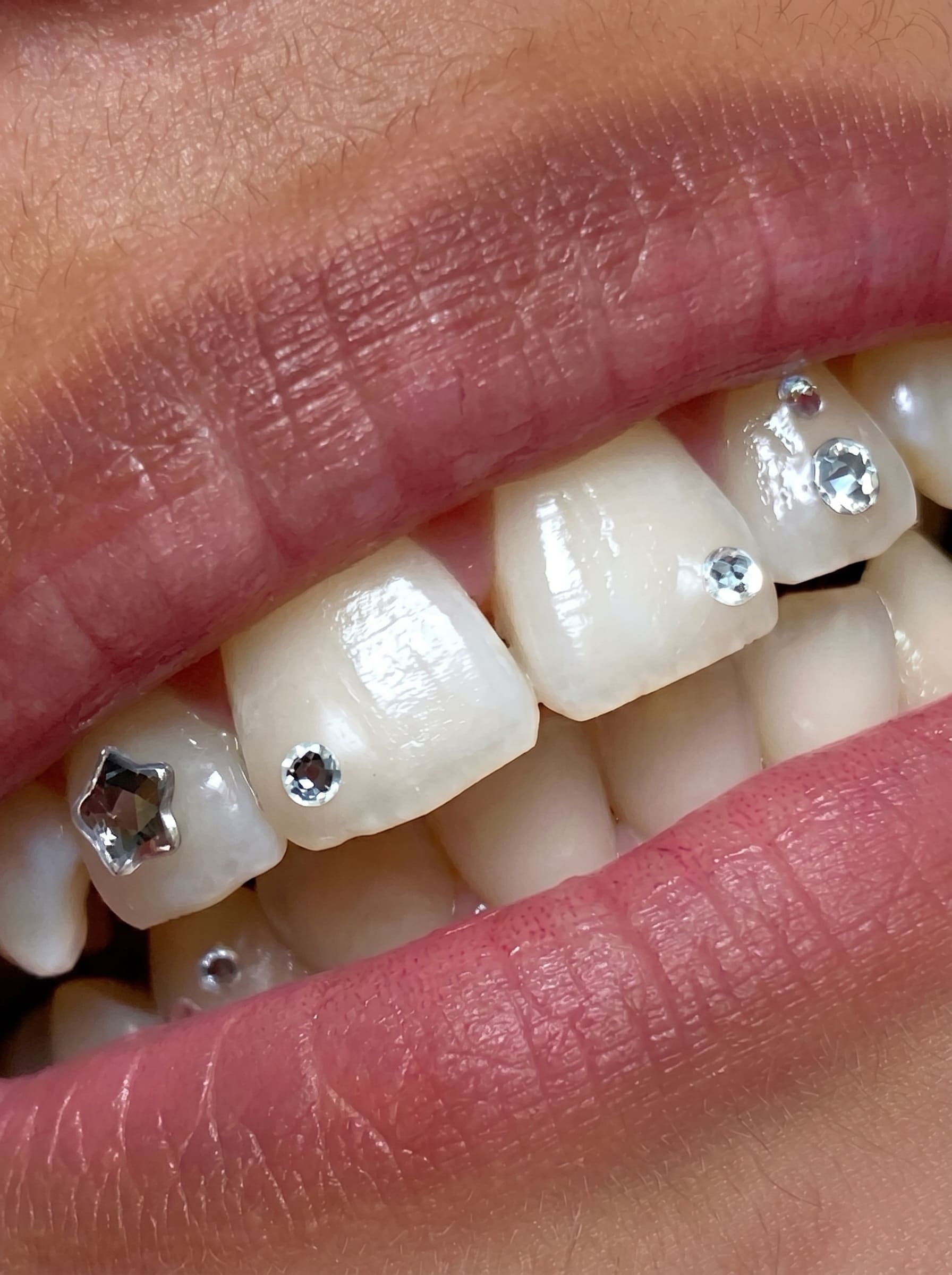 Tooth Jewellery in Chandigarh