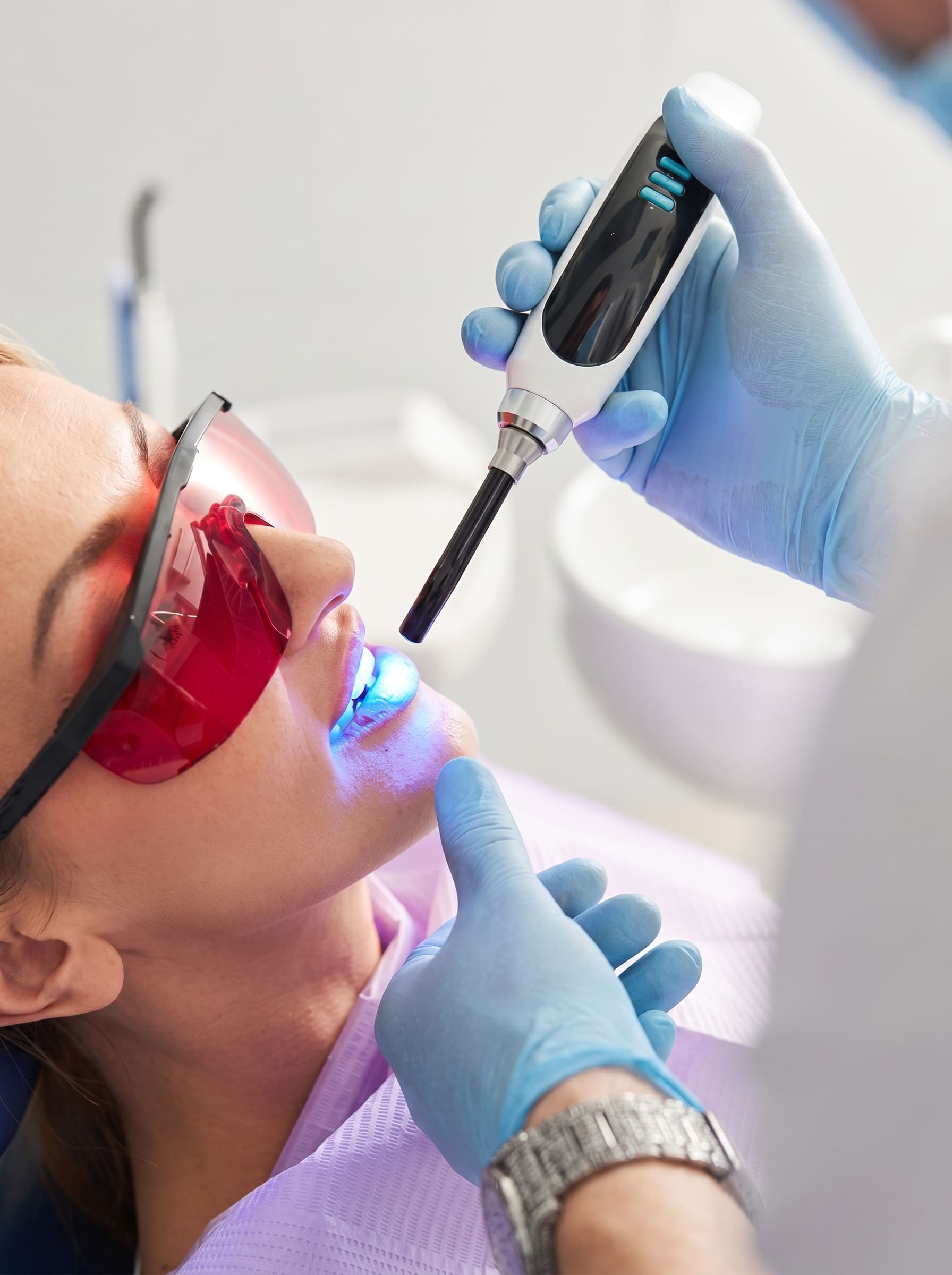 Dental Sealants in Chandigarh