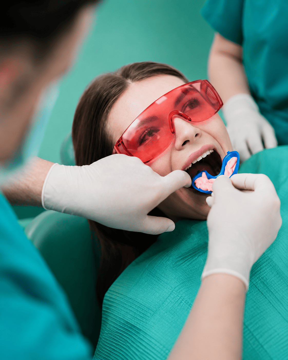 Fluoride Treatment in Chandigarh Fluoride Treatment in Chandigarh