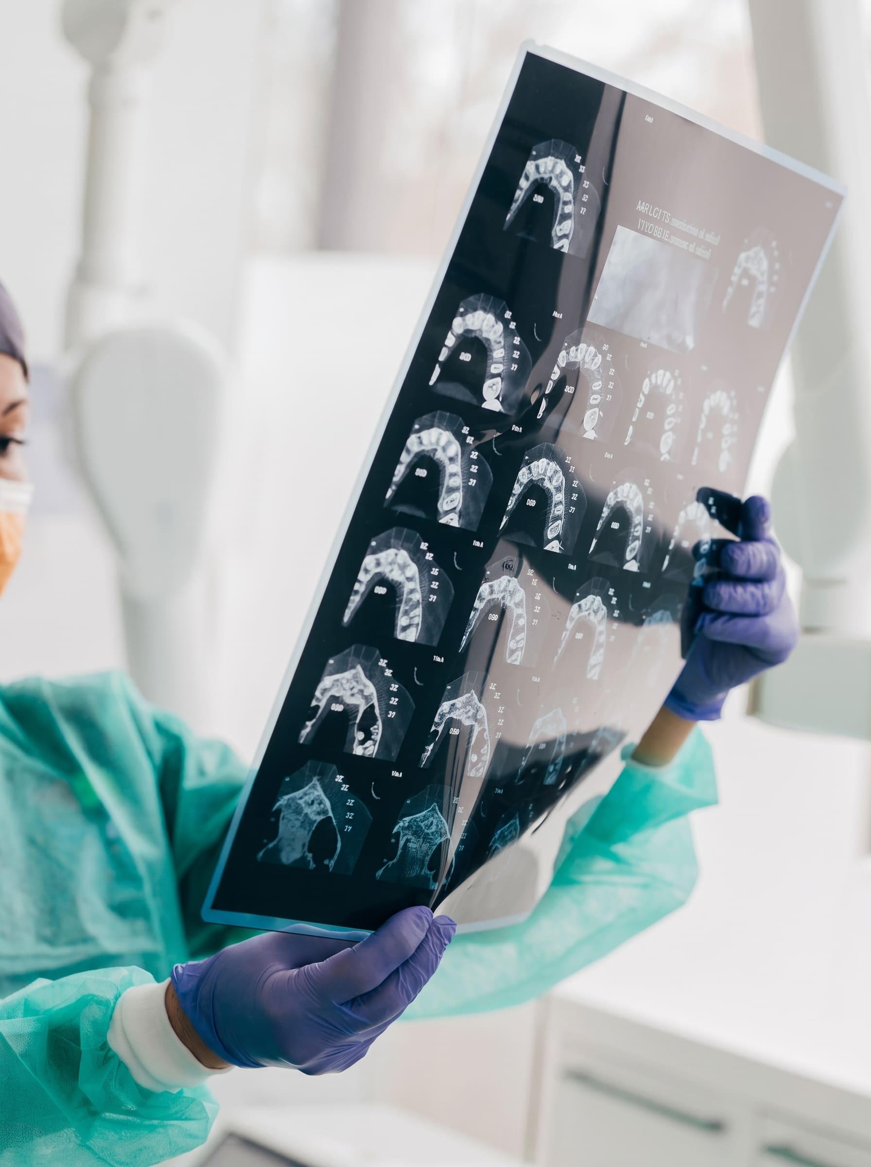 Dental X-Ray in Chandigarh (2) (1) Dental X-Ray in Chandigarh