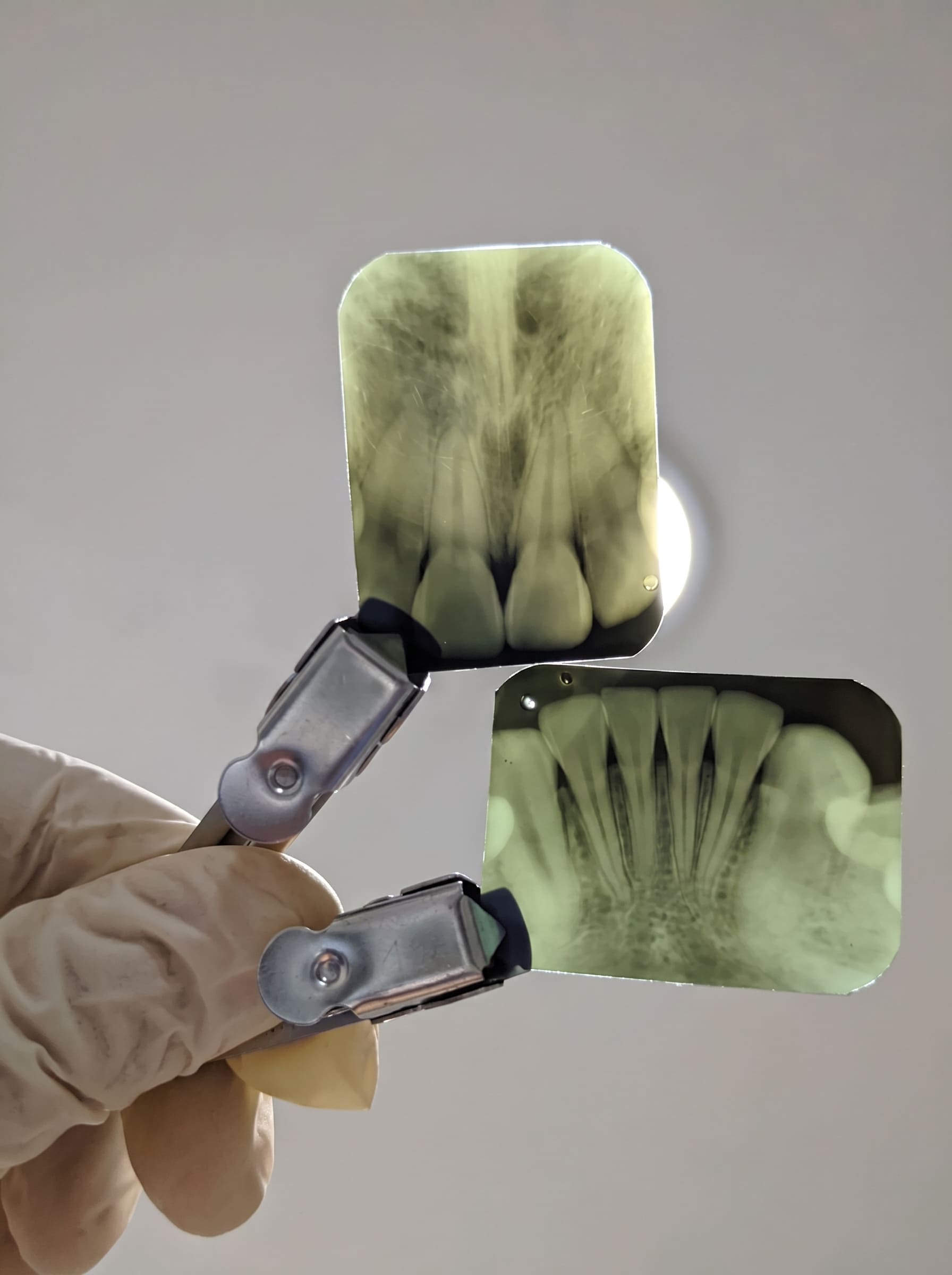 Dental X-Ray in Chandigarh (3) (1)