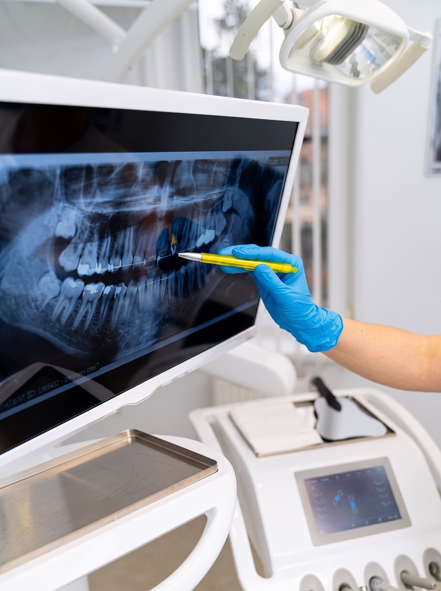 Dental X-Ray in Chandigarh Dental X-Ray in Chandigarh