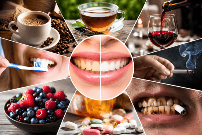 Teeth whitening treatment